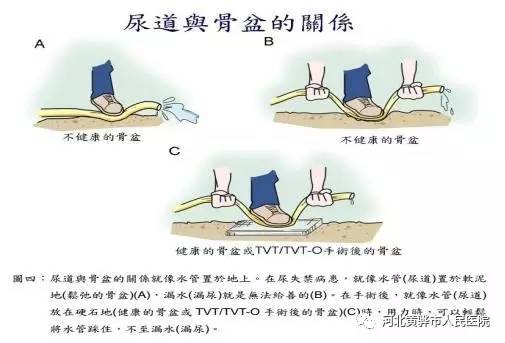 “国际尿失禁周”公益讲座加义诊—关注尿失禁，关爱女性泌尿健康