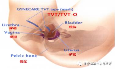 “国际尿失禁周”公益讲座加义诊—关注尿失禁，关爱女性泌尿健康